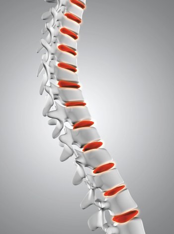 Endoscopic Spine Surgery