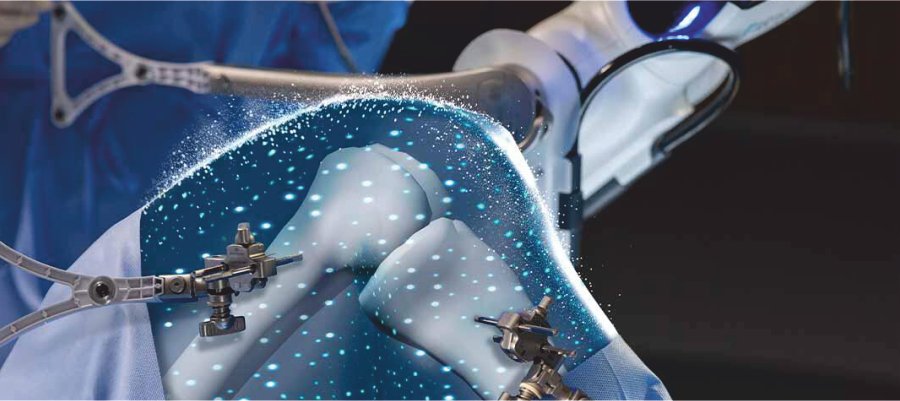 Robotics Joint Replacement at ASTHA Hospital